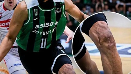 好可怕的膝盖！两次ACL撕裂，他还在打球！！！